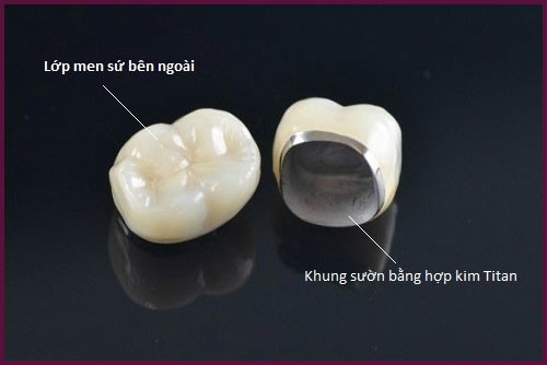 cau-tao-rang-boc-su