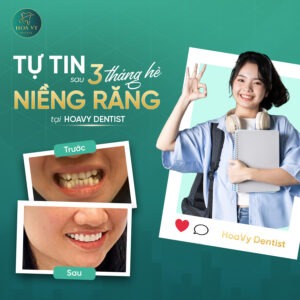 Niềng răng cho con ở Hải Phòng – Giải pháp chỉnh nha an toàn, giúp trẻ tự tin với nụ cười rạng rỡ