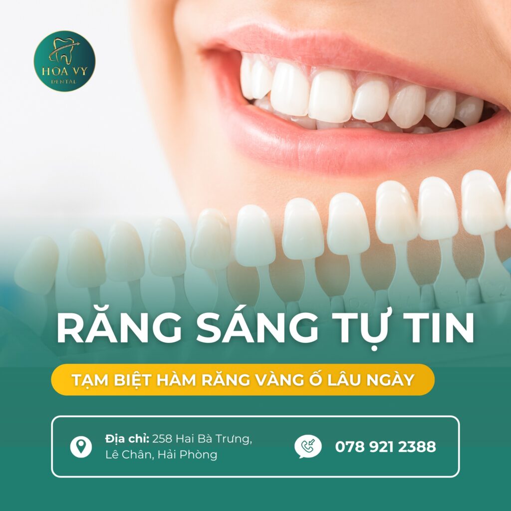 Công nghệ tẩy trắng răng tại HoaVy Dental cam kết - Loại bỏ mảng bám, ố vàng lâu năm chỉ sau 1 liệu trình - An toàn cho men răng và nướu - Hiệu quả dài lâu